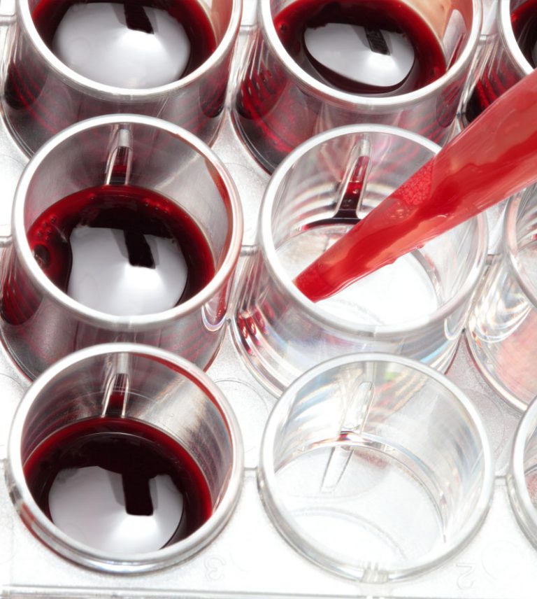 Blood Assay Solutions A wide range of blood assay services